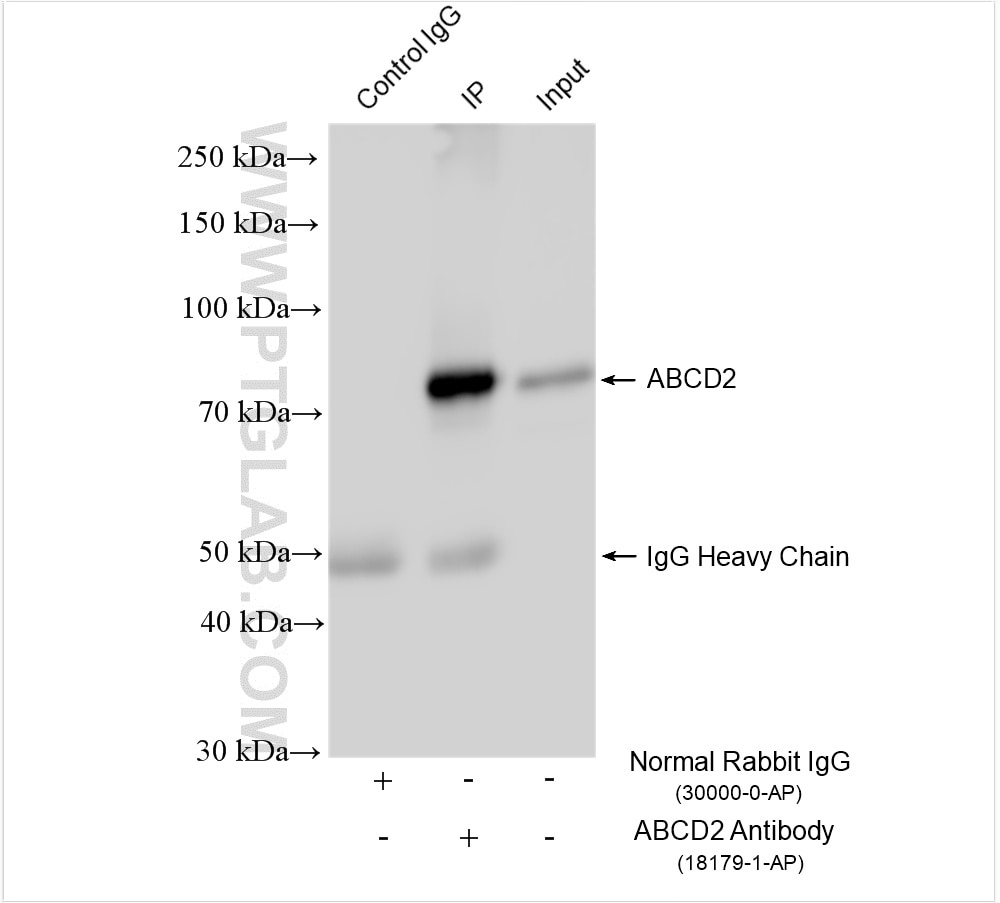 Immunoprecipitation (IP) experiment of mouse adipose tissue using ABCD2 Polyclonal antibody (18179-1-AP)