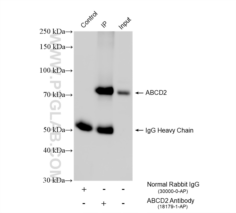 Immunoprecipitation (IP) experiment of mouse adipose tissue using ABCD2 Polyclonal antibody (18179-1-AP)