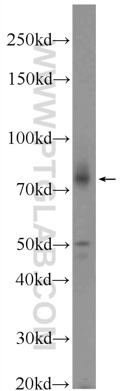 Western Blot (WB) analysis of mouse cerebellum tissue using ABCD2 Polyclonal antibody (18179-1-AP)