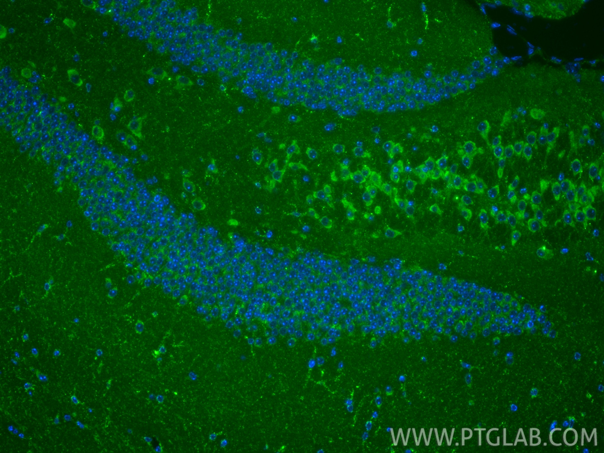 IF Staining of mouse brain using 86519-4-RR (same clone as 86519-4-PBS) Immunofluorescence (IF) / fluorescent staining of mouse brain tissue using ABCD2 Recombinant monoclonal antibody (86519-4-RR)
