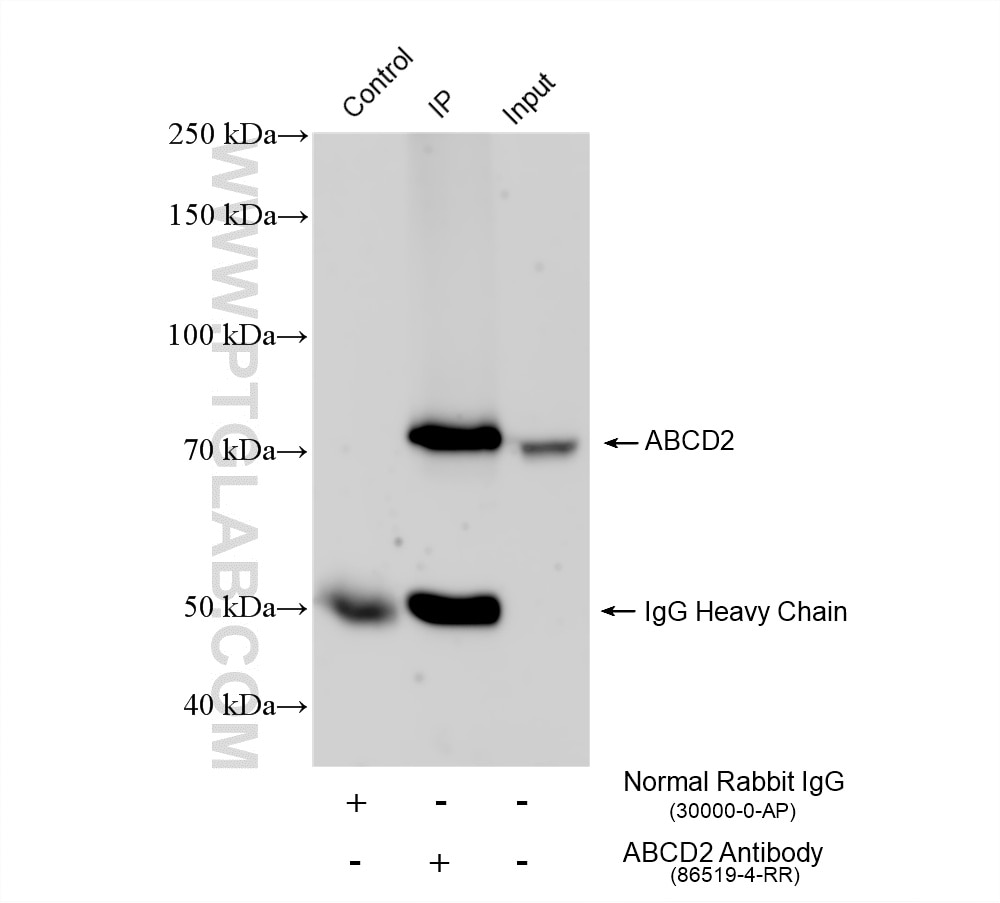 Immunoprecipitation (IP) experiment of mouse cerebellum tissue using ABCD2 Recombinant monoclonal antibody (86519-4-RR)
