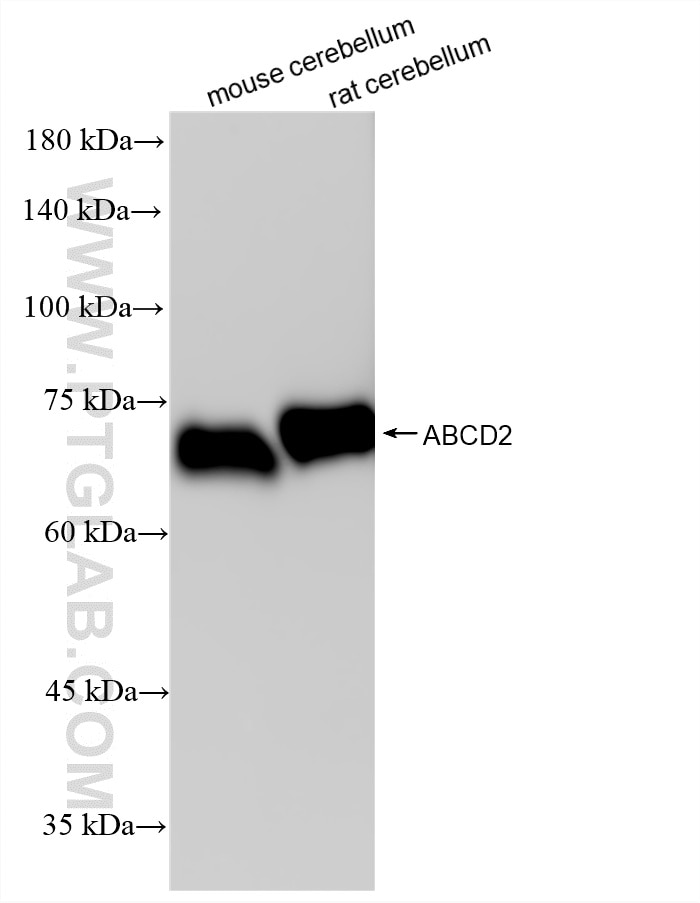 Western Blot (WB) analysis of various lysates using ABCD2 Recombinant monoclonal antibody (86519-4-RR)