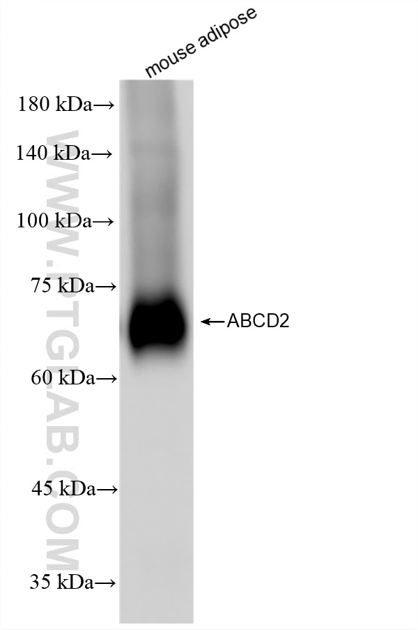 Western Blot (WB) analysis of various lysates using ABCD2 Recombinant monoclonal antibody (86519-4-RR)