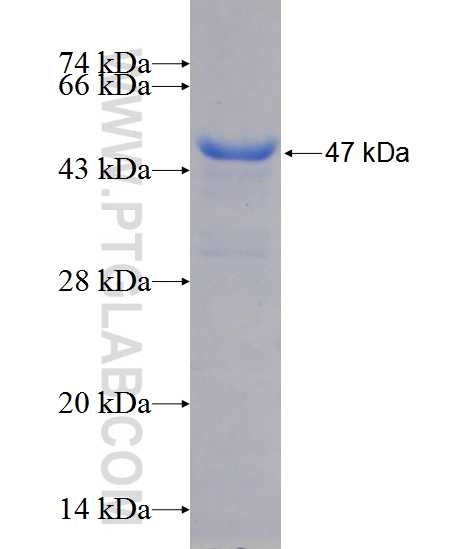 ABCD2 fusion protein Ag12885 SDS-PAGE