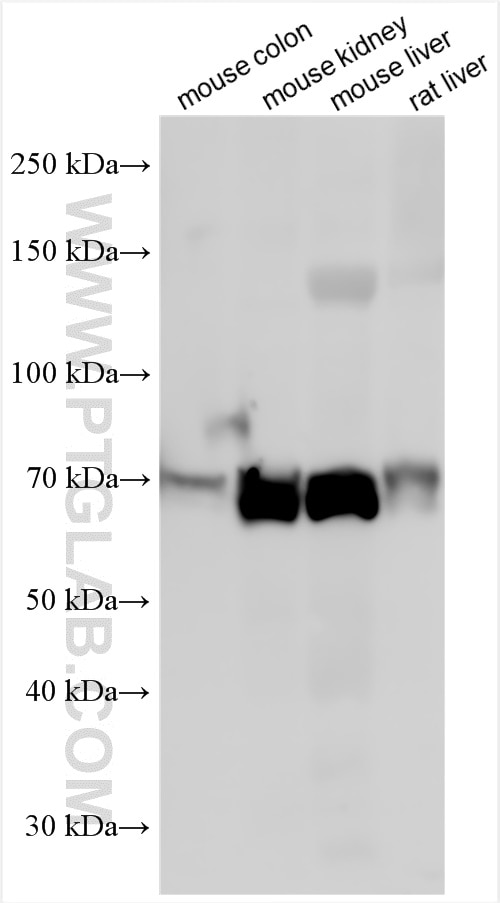 Western Blot (WB) analysis of various lysates using ABCD3 Polyclonal antibody (26720-1-AP)