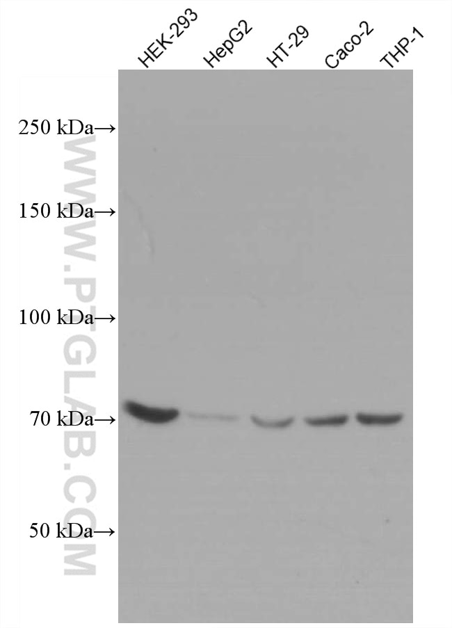Western Blot (WB) analysis of various lysates using ABCD3 Monoclonal antibody (66697-1-Ig)