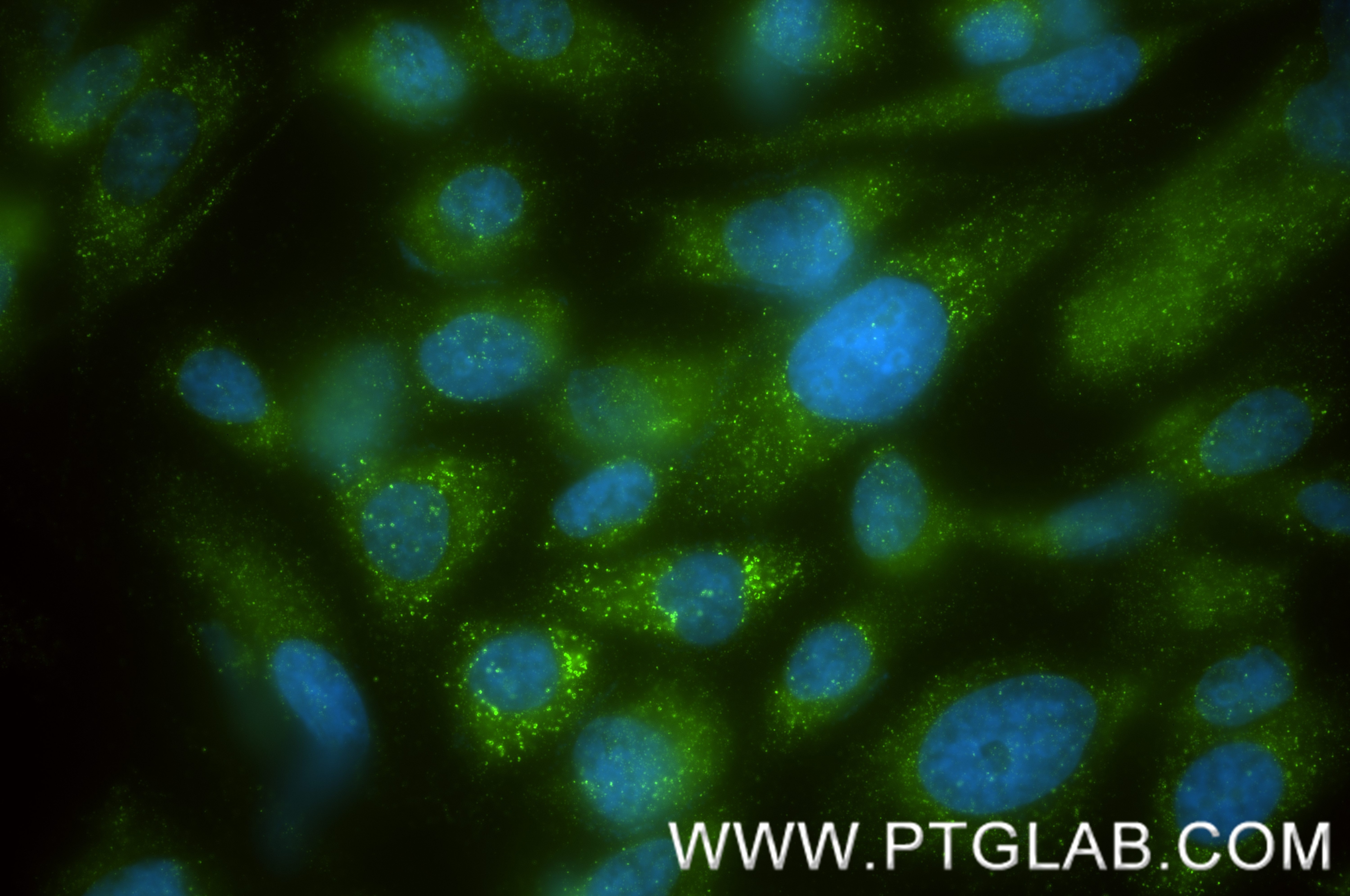 Immunofluorescence (IF) / fluorescent staining of PC-3 cells using ABCD3 Recombinant monoclonal antibody (87047-1-RR)