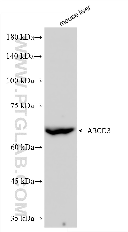 Western Blot (WB) analysis of mouse liver tissue using ABCD3 Recombinant monoclonal antibody (87047-1-RR)