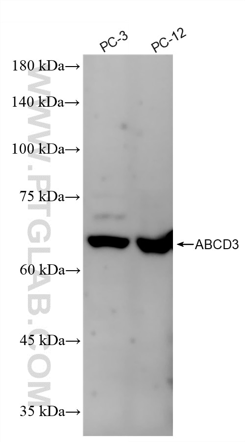 Western Blot (WB) analysis of various lysates using ABCD3 Recombinant monoclonal antibody (87047-1-RR)