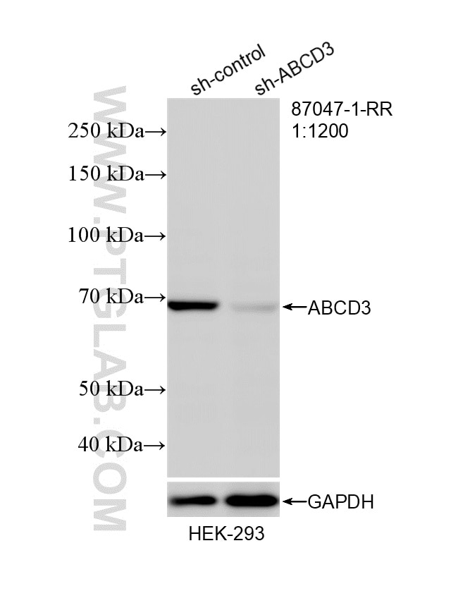 Western Blot (WB) analysis of HEK-293 cells using ABCD3 Recombinant monoclonal antibody (87047-1-RR)