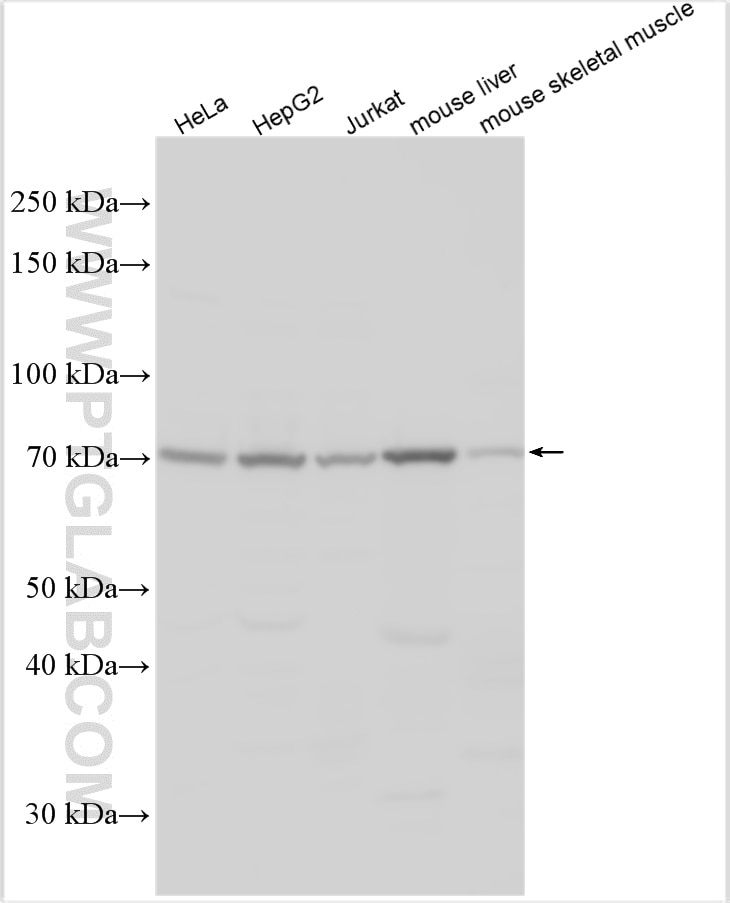 Western Blot (WB) analysis of various lysates using ABCD4 Polyclonal antibody (15935-1-AP)
