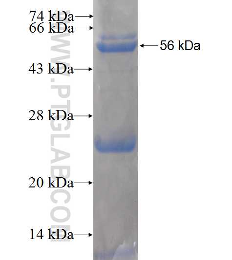 ABCD4 fusion protein Ag8783 SDS-PAGE