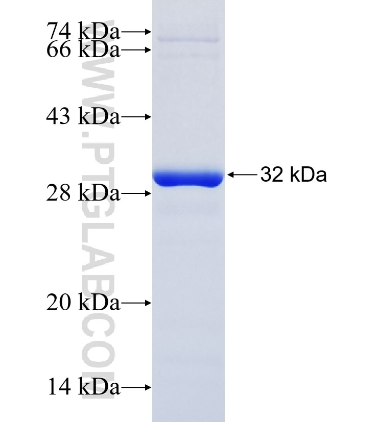 ABCD4 fusion protein Ag8955 SDS-PAGE