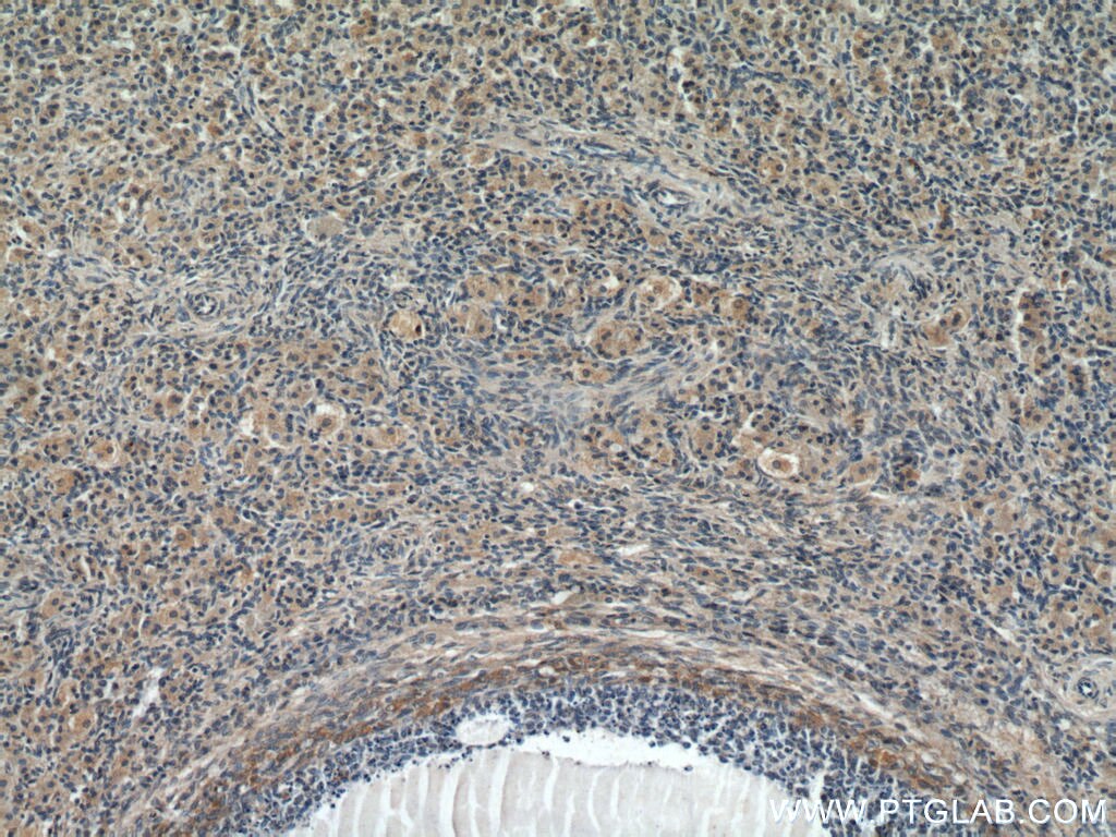 Immunohistochemistry (IHC) staining of human ovary tissue using ABCE1 Polyclonal antibody (51008-2-AP)