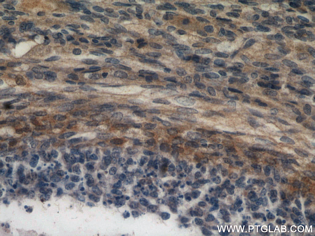 Immunohistochemistry (IHC) staining of human ovary tissue using ABCE1 Polyclonal antibody (51008-2-AP)