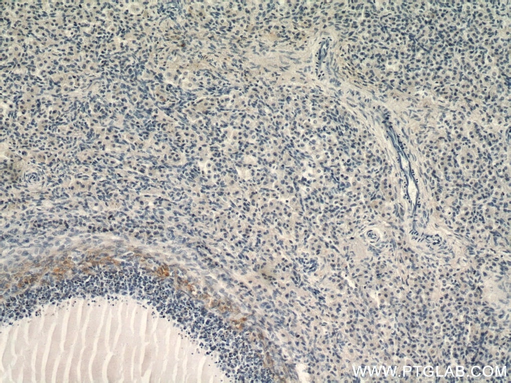 Immunohistochemistry (IHC) staining of human ovary tissue using ABCE1 Polyclonal antibody (51008-2-AP)