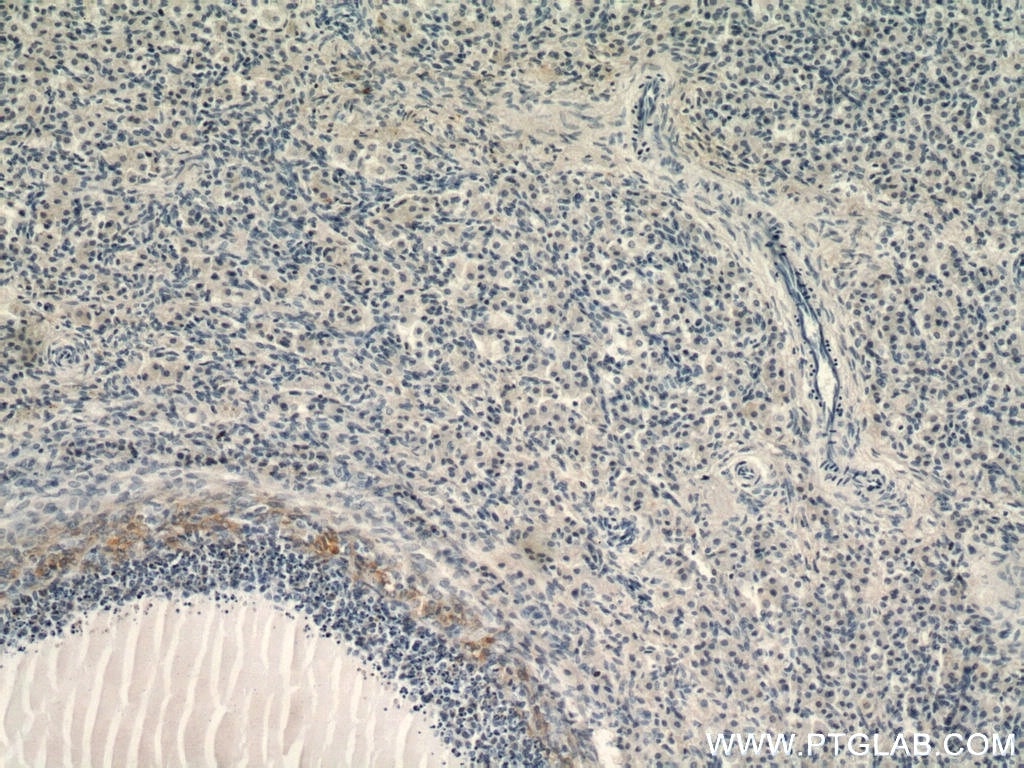 IHC staining of human ovary using 51008-2-AP