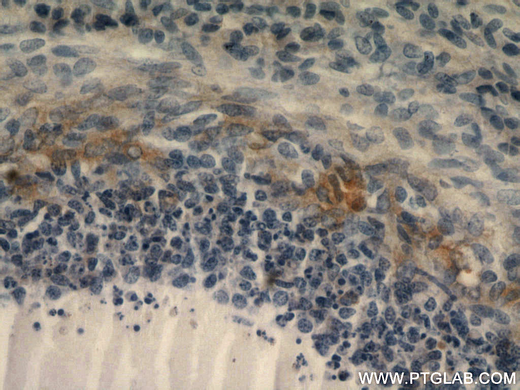 IHC staining of human ovary using 51008-2-AP