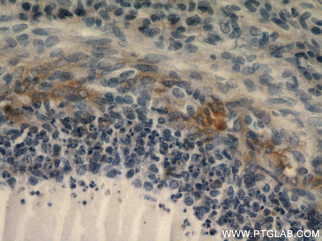 Immunohistochemistry (IHC) staining of human ovary tissue using ABCE1 Polyclonal antibody (51008-2-AP)