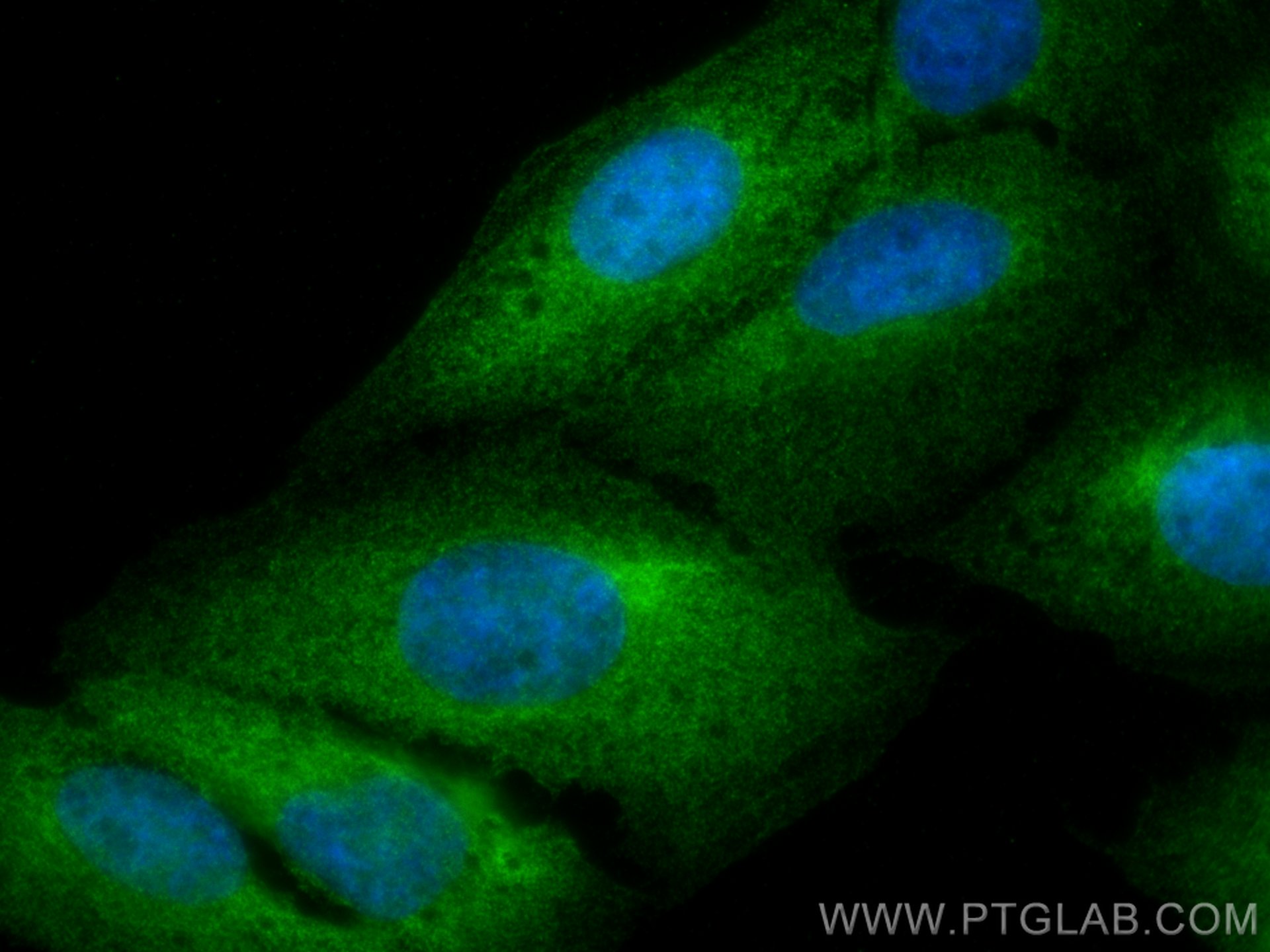 Immunofluorescence (IF) / fluorescent staining of U2OS cells using ABCE1 Monoclonal antibody (67960-1-Ig)
