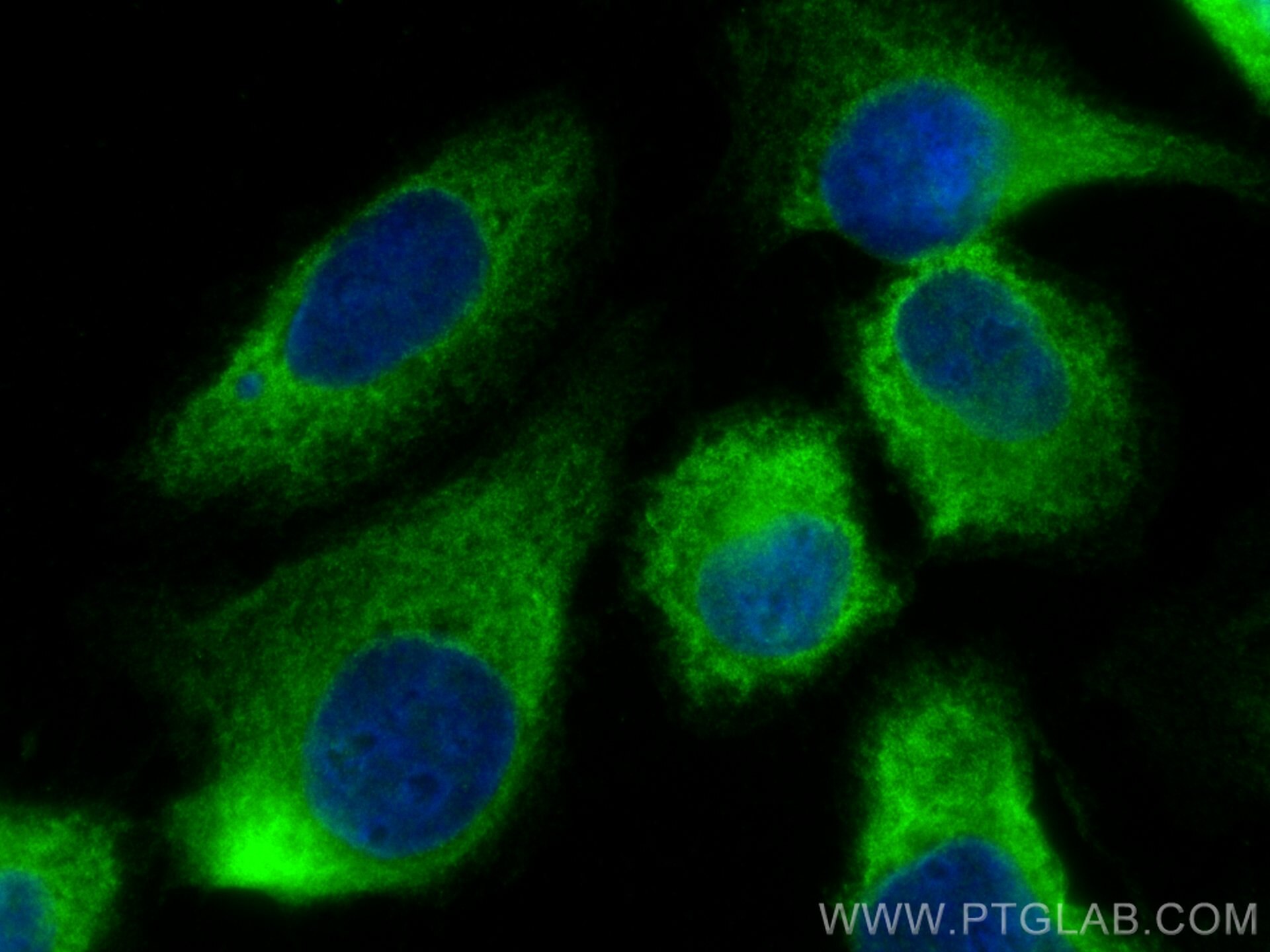 Immunofluorescence (IF) / fluorescent staining of U2OS cells using ABCE1 Monoclonal antibody (67960-1-Ig)