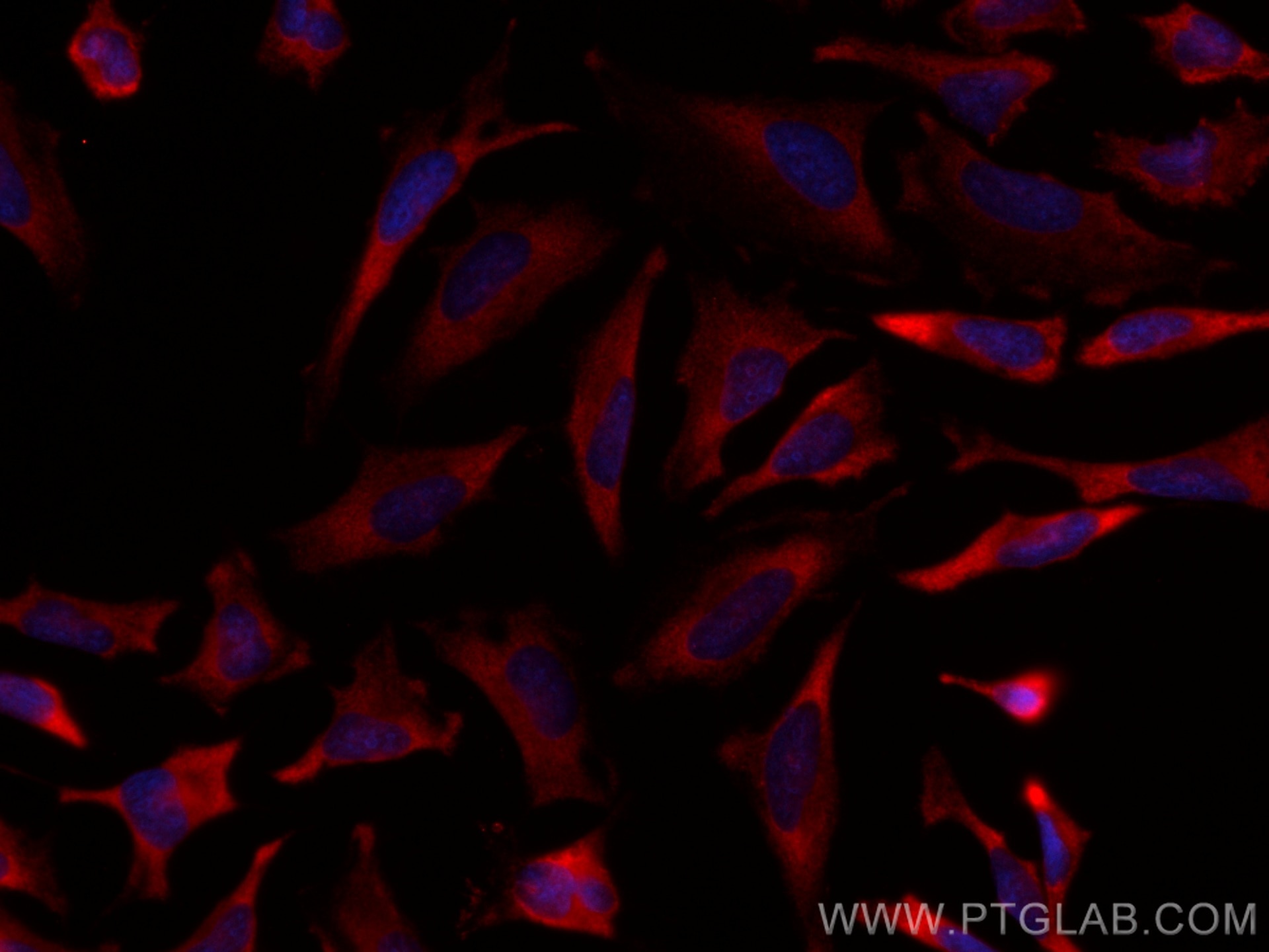 Immunofluorescence (IF) / fluorescent staining of HeLa cells using CoraLite®594-conjugated ABCE1 Monoclonal antibody (CL594-67960)