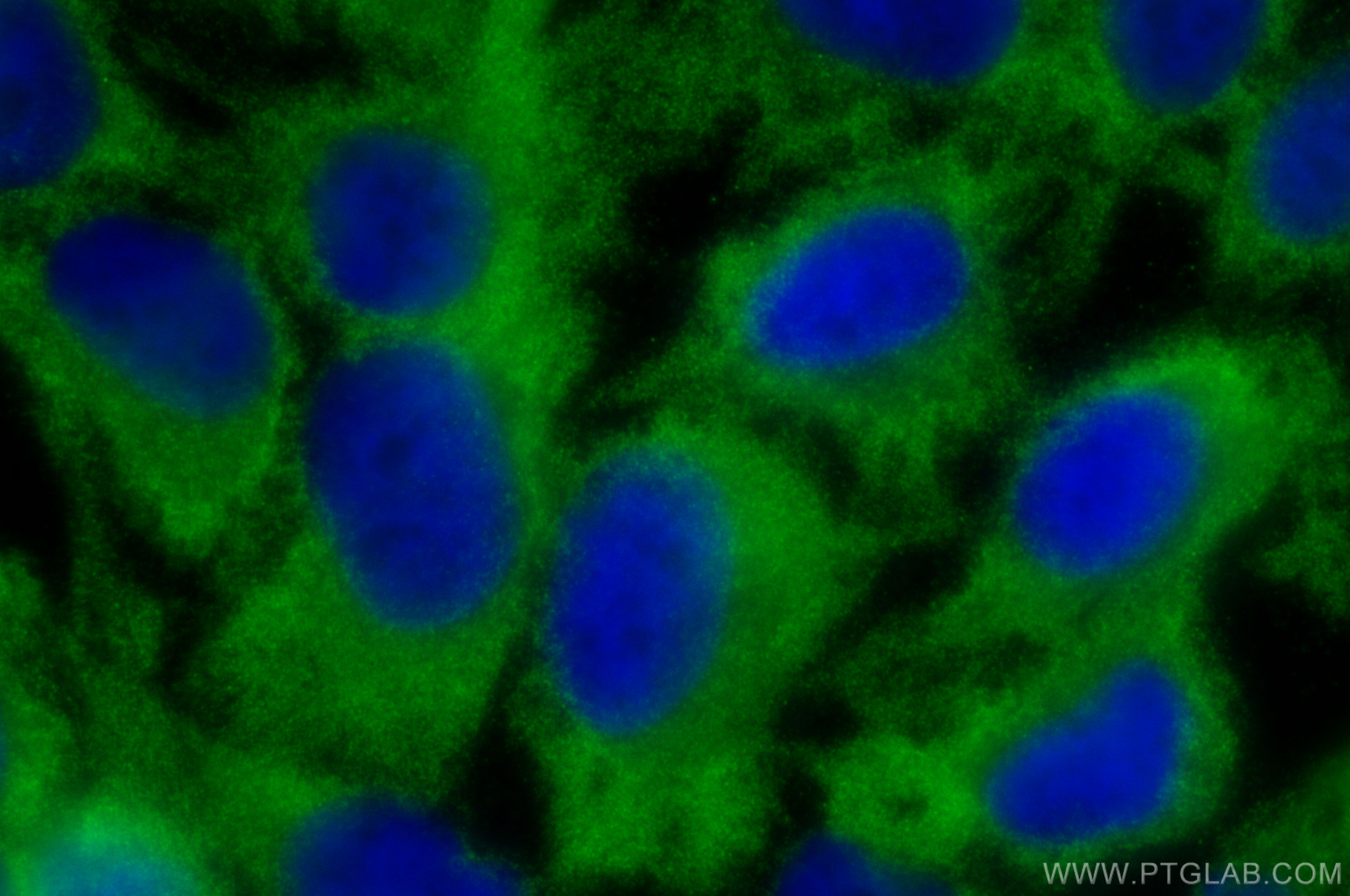 Immunofluorescence (IF) / fluorescent staining of HeLa cells using ABCF1 Polyclonal antibody (13950-1-AP)