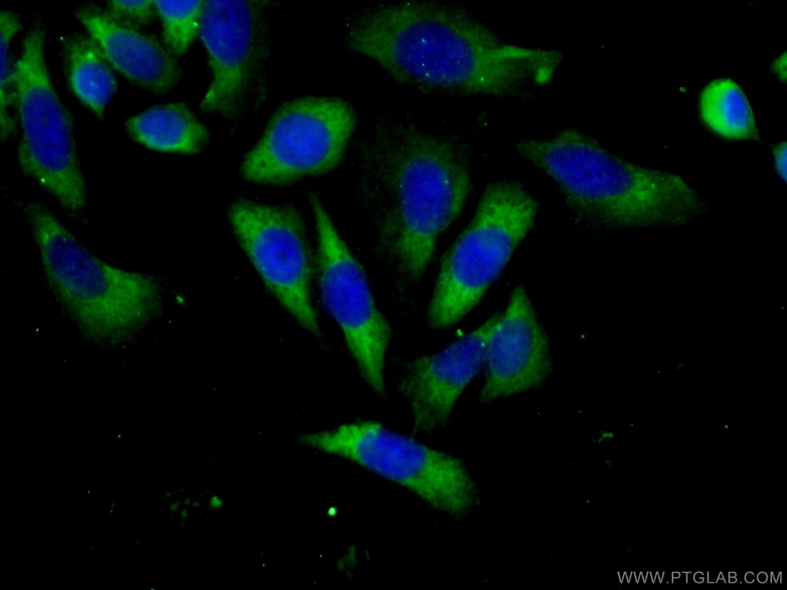 IF Staining of HeLa using 13950-1-AP