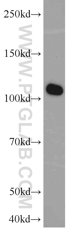 Western Blot (WB) analysis of K-562 cells using ABCF1 Polyclonal antibody (13950-1-AP)