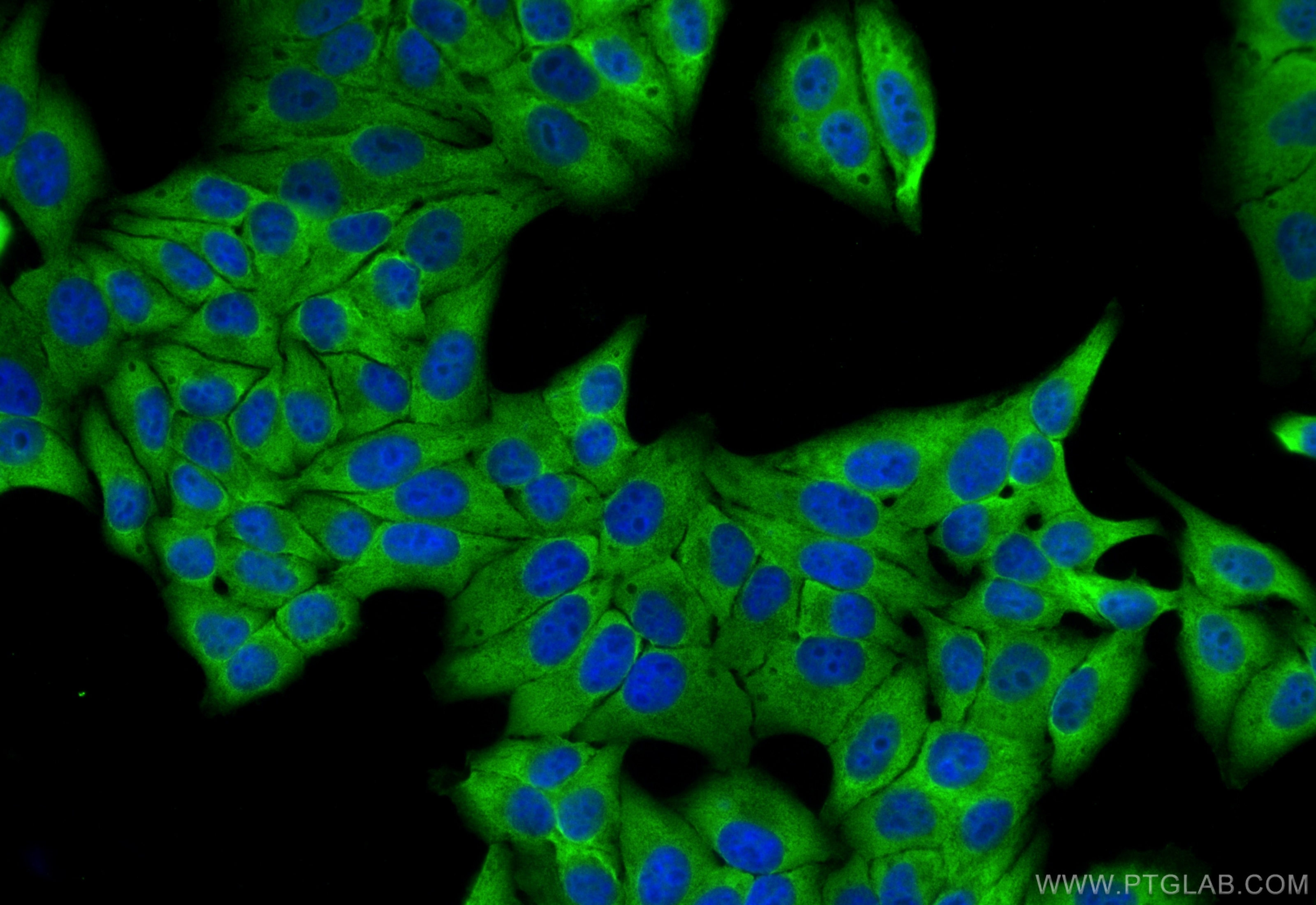 Immunofluorescence (IF) / fluorescent staining of HepG2 cells using ABCF2 Polyclonal antibody (10226-1-AP)
