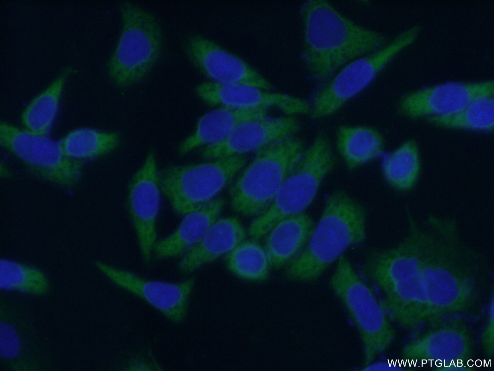 Immunofluorescence (IF) / fluorescent staining of HeLa cells using ABCF2 Polyclonal antibody (10226-1-AP)