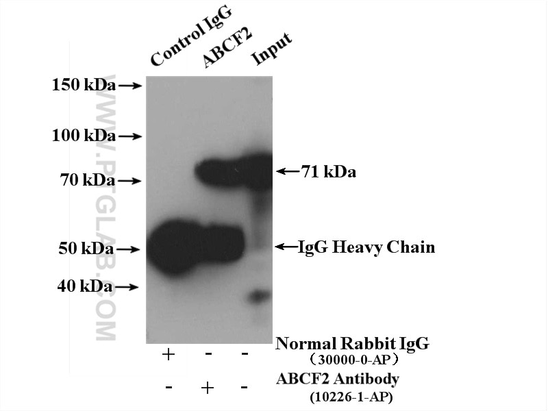 Immunoprecipitation (IP) experiment of HeLa cells using ABCF2 Polyclonal antibody (10226-1-AP)