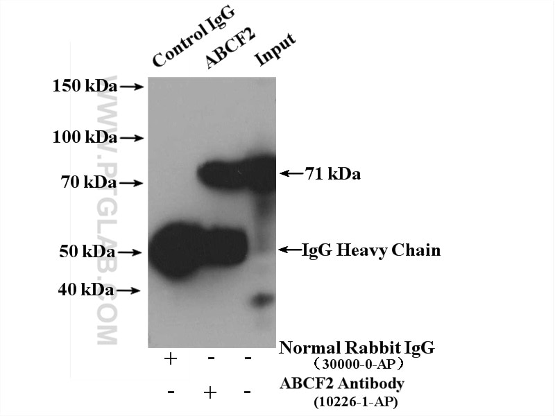 IP experiment of HeLa using 10226-1-AP