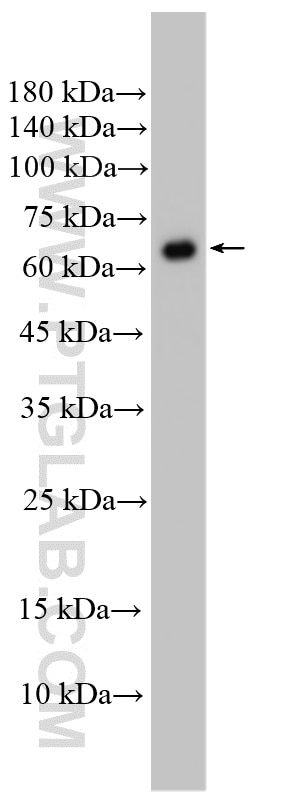 Western Blot (WB) analysis of HeLa cells using ABCF2 Polyclonal antibody (10226-1-AP)
