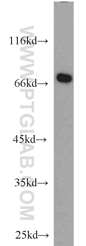 Western Blot (WB) analysis of HEK-293 cells using ABCF2 Polyclonal antibody (10226-1-AP)