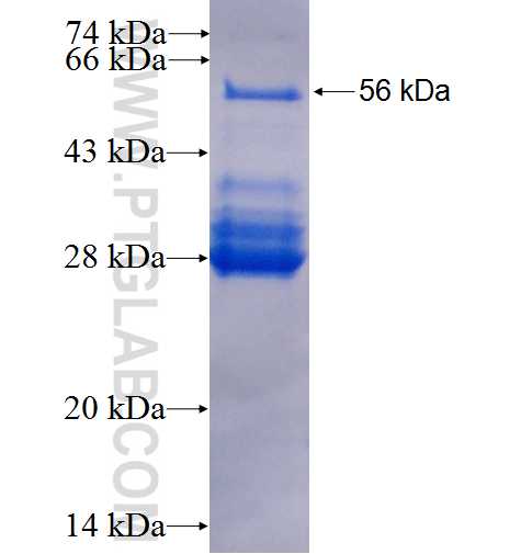 ABCF2 fusion protein Ag0310 SDS-PAGE