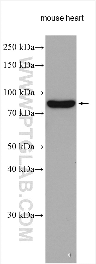 Western Blot (WB) analysis of various lysates using ABCF3 Polyclonal antibody (15984-1-AP)