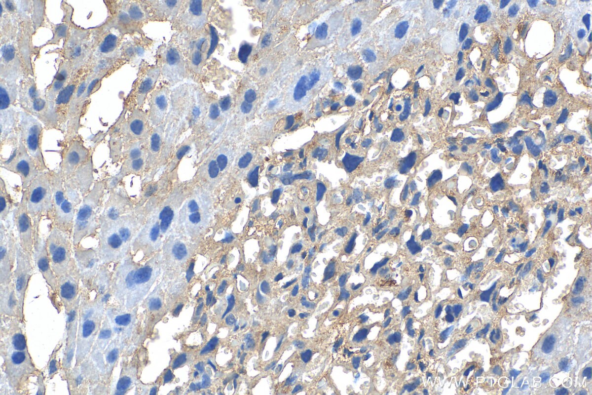 Immunohistochemistry (IHC) staining of mouse placenta tissue using ABCG1 Polyclonal antibody (13578-1-AP)