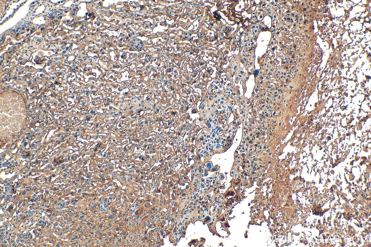 IHC staining of mouse placenta using 13578-1-AP