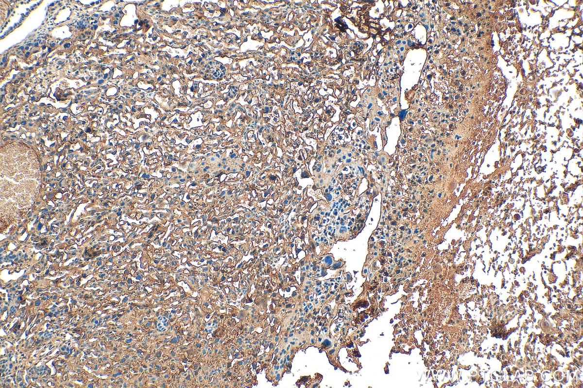 Immunohistochemistry (IHC) staining of mouse placenta tissue using ABCG1 Polyclonal antibody (13578-1-AP)