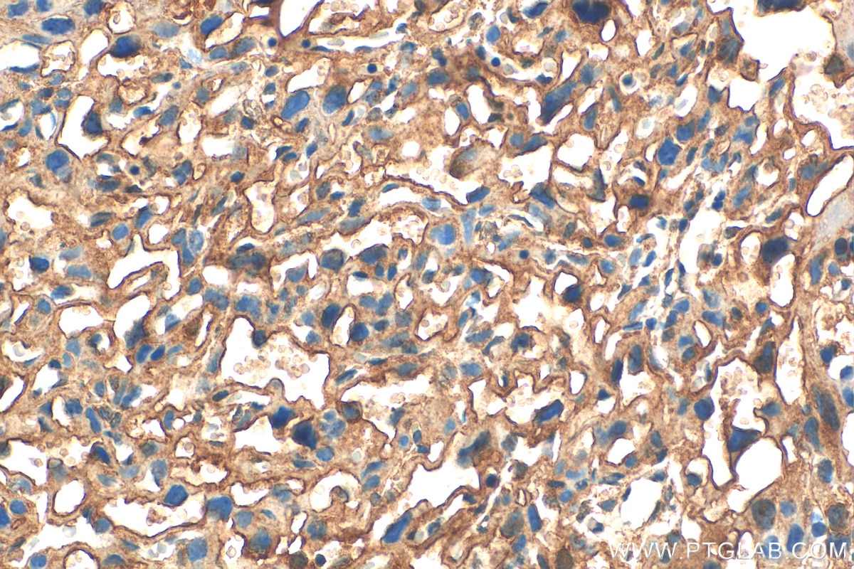 Immunohistochemistry (IHC) staining of mouse placenta tissue using ABCG1 Polyclonal antibody (13578-1-AP)