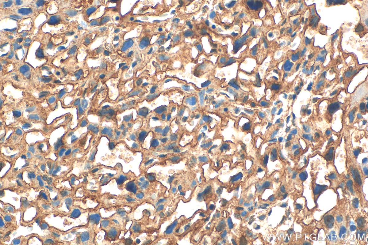 IHC staining of mouse placenta using 13578-1-AP