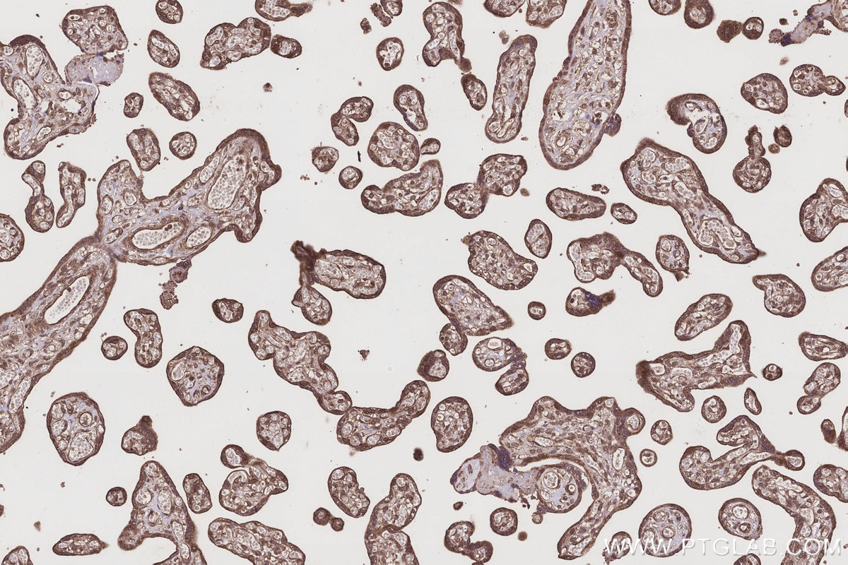 Immunohistochemistry (IHC) staining of human placenta tissue using ABCG1 Polyclonal antibody (13578-1-AP)