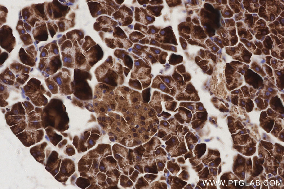 Immunohistochemistry (IHC) staining of mouse pancreas tissue using ABCG1 Polyclonal antibody (13578-1-AP)