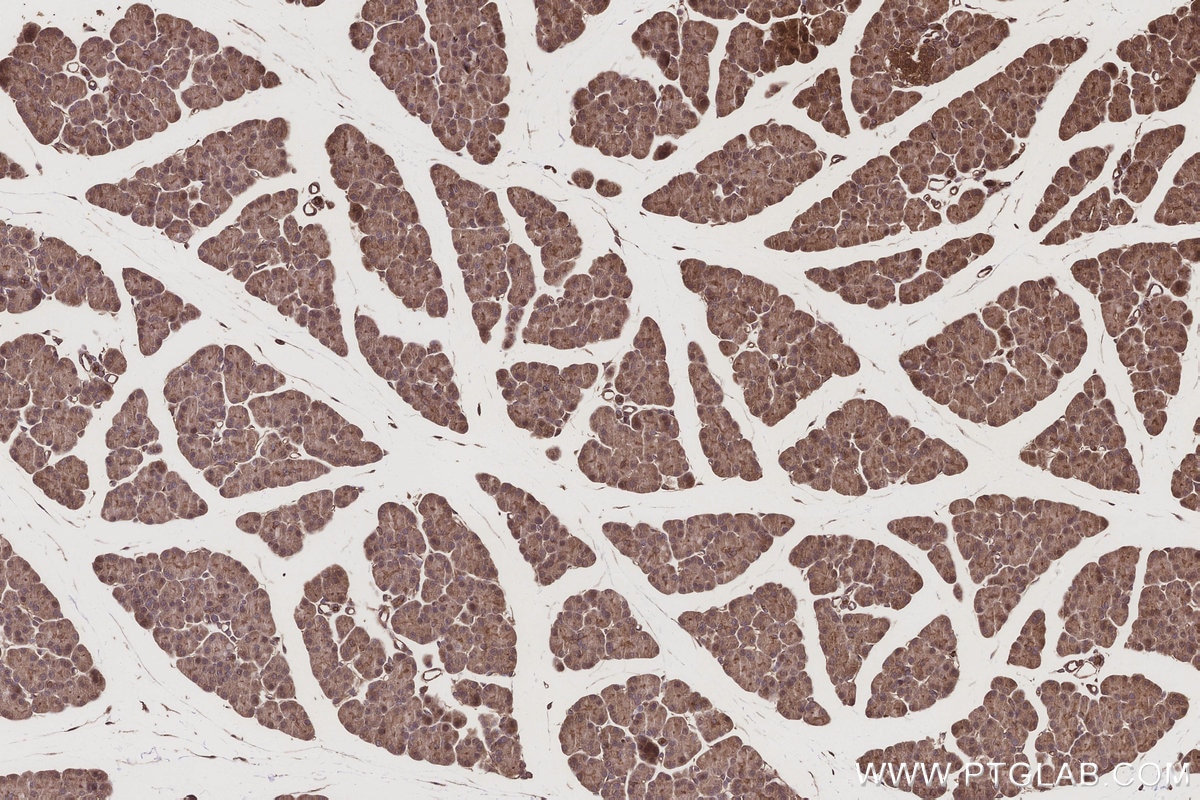 Immunohistochemistry (IHC) staining of rat pancreas tissue using ABCG1 Polyclonal antibody (13578-1-AP)