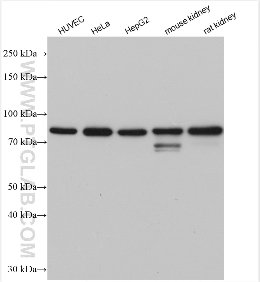 Western Blot (WB) analysis of various lysates using ABCG1 Polyclonal antibody (13578-1-AP)