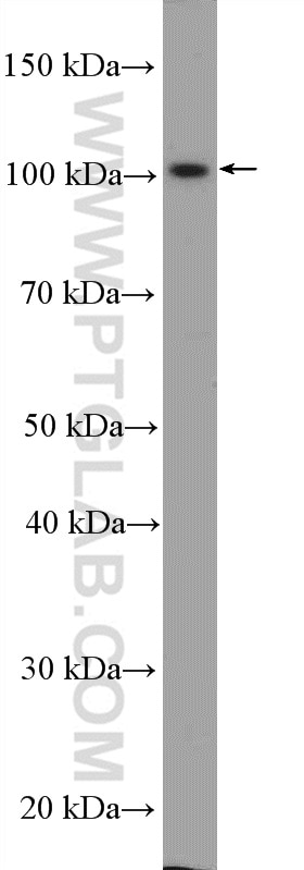 WB analysis of mouse brain using 14269-1-AP