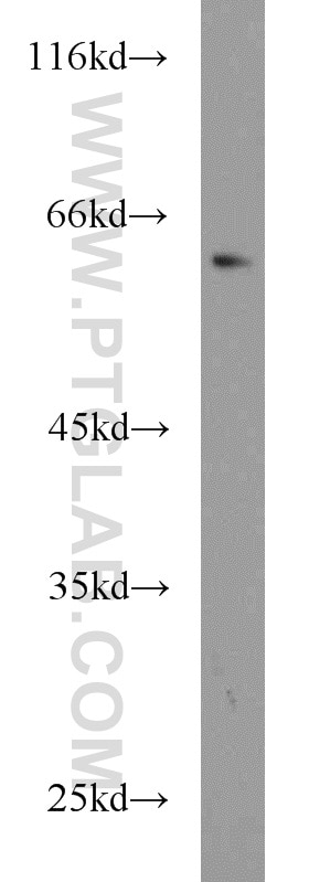 Western Blot (WB) analysis of U-937 cells using ABCG4 Polyclonal antibody (14269-1-AP)