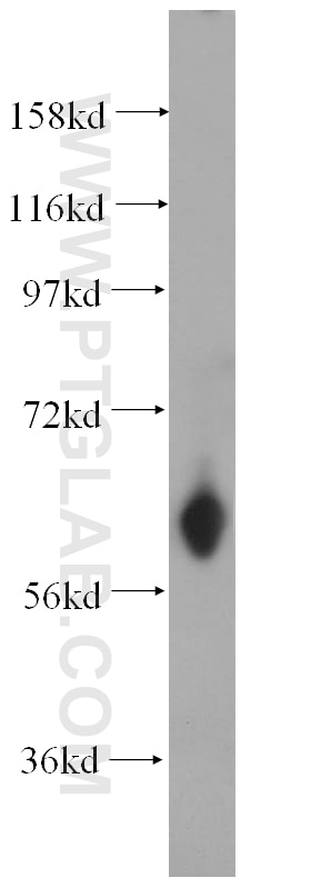 Western Blot (WB) analysis of U-937 cells using ABCG4 Polyclonal antibody (14269-1-AP)
