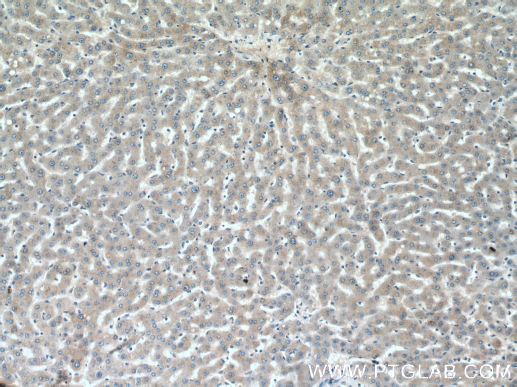 Immunohistochemistry (IHC) staining of human liver tissue using ABCG5 Polyclonal antibody (27722-1-AP)